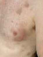 closeup of DM's bruises
